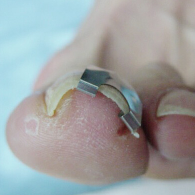 つめクリップ